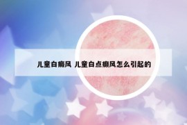 兒童白癜風(fēng) 兒童白點癲風(fēng)怎么引起的