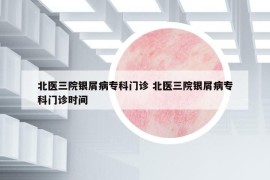 北醫(yī)三院銀屑病?？崎T診 北醫(yī)三院銀屑病?？崎T診時間