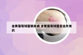 金黃葡萄球菌銀屑病 金黃葡萄球菌首選外用藥