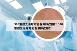 308準(zhǔn)激光治療時能否涂抹孜然酊 308準(zhǔn)激光治療時能否涂抹孜然酊