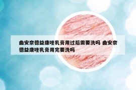 曲安奈德益康唑乳膏用過后需要洗嗎 曲安奈德益康唑乳膏用完要洗嗎