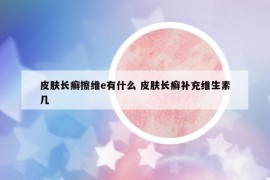 皮膚長癬擦維e有什么 皮膚長癬補(bǔ)充維生素幾