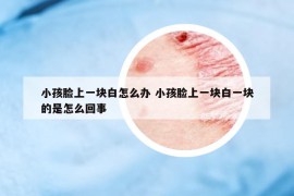 小孩臉上一塊白怎么辦 小孩臉上一塊白一塊的是怎么回事