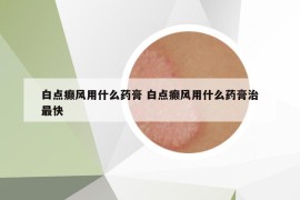 白點癲風(fēng)用什么藥膏 白點癲風(fēng)用什么藥膏治最快