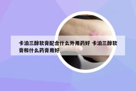 卡泊三醇軟膏配合什么外用藥好 卡泊三醇軟膏和什么藥膏用好