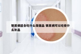 銀屑病適合吃什么保健品 銀屑病可以吃些什么補(bǔ)品