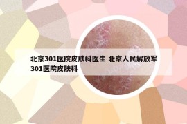 北京301醫(yī)院皮膚科醫(yī)生 北京人民解放軍301醫(yī)院皮膚科