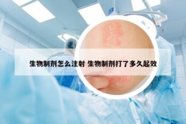 生物制劑怎么注射 生物制劑打了多久起效
