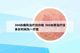 308白癜風(fēng)治療儀價(jià)格 308白斑治療儀多長時(shí)間為一療程