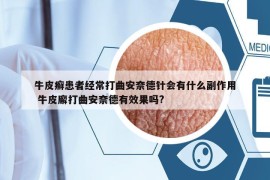 牛皮癬患者經(jīng)常打曲安奈德針會有什么副作用 牛皮廨打曲安奈德有效果嗎?