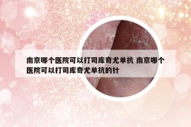 南京哪個醫(yī)院可以打司庫奇尤單抗 南京哪個醫(yī)院可以打司庫奇尤單抗的針