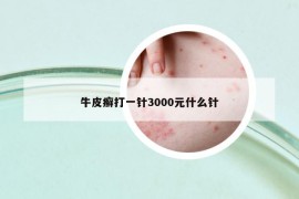 牛皮癬打一針3000元什么針