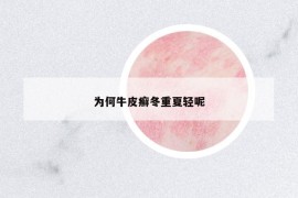 為何牛皮癬冬重夏輕呢