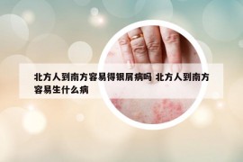 北方人到南方容易得銀屑病嗎 北方人到南方容易生什么病