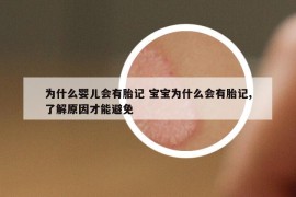 為什么嬰兒會有胎記 寶寶為什么會有胎記,了解原因才能避免