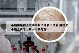 小腿和胳膊上旅游后長了許多小白點 胳膊上小腿上長了一片小小的疙瘩