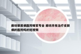 廊坊銀屑病醫(yī)院哪家專業(yè) 廊坊市有治療皮膚病的醫(yī)院嗎的短視頻
