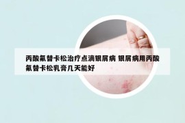 丙酸氟替卡松治療點滴銀屑病 銀屑病用丙酸氟替卡松乳膏幾天能好