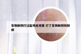 生物制劑打過(guò)起雞皮疙瘩 打了生物制劑特別癢