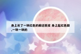身上長了一塊紅色的癬還脫皮 身上起紅色蘚,一塊一塊的