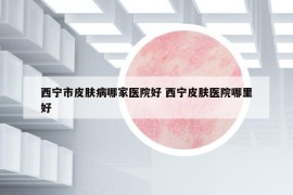 西寧市皮膚病哪家醫(yī)院好 西寧皮膚醫(yī)院哪里好