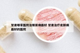 甘肅哪家醫(yī)院治銀屑病最好 甘肅治療皮膚病最好的醫(yī)院