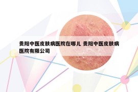 貴陽(yáng)中醫(yī)皮膚病醫(yī)院在哪兒 貴陽(yáng)中醫(yī)皮膚病醫(yī)院有限公司