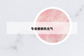 牛皮癬損傷元氣