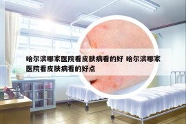 哈爾濱哪家醫(yī)院看皮膚病看的好 哈爾濱哪家醫(yī)院看皮膚病看的好點(diǎn)