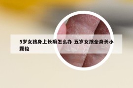 5歲女孩身上長癬怎么辦 五歲女孩全身長小顆粒