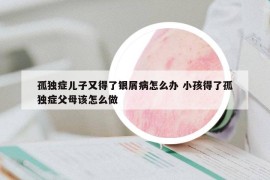 孤獨(dú)癥兒子又得了銀屑病怎么辦 小孩得了孤獨(dú)癥父母該怎么做