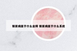銀屑病屬于什么業(yè)障 銀屑病屬于什么系統(tǒng)