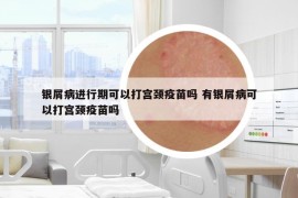 銀屑病進(jìn)行期可以打?qū)m頸疫苗嗎 有銀屑病可以打?qū)m頸疫苗嗎