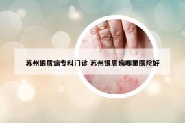 蘇州銀屑病?？崎T診 蘇州銀屑病哪里醫(yī)院好