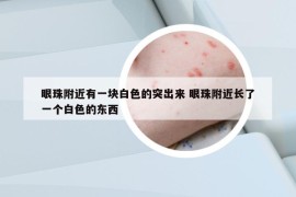 眼珠附近有一塊白色的突出來 眼珠附近長了一個(gè)白色的東西