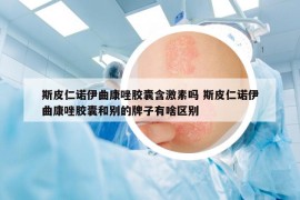 斯皮仁諾伊曲康唑膠囊含激素嗎 斯皮仁諾伊曲康唑膠囊和別的牌子有啥區(qū)別