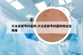 興義皮膚?？漆t(yī)院 興義皮膚?？漆t(yī)院地址在哪里