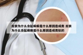 皮膚為什么會(huì)起癬癬是什么原因造成類 皮膚為什么會(huì)起癬癬是什么原因造成類似的