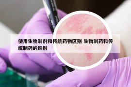 使用生物制劑和傳統(tǒng)藥物區(qū)別 生物制藥和傳統(tǒng)制藥的區(qū)別