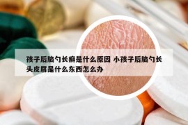 孩子后腦勺長(zhǎng)癬是什么原因 小孩子后腦勺長(zhǎng)頭皮屑是什么東西怎么辦