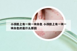 小孩臉上有一塊一塊白色 小孩臉上有一塊一塊白色的是什么原因