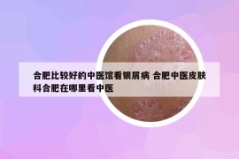 合肥比較好的中醫(yī)館看銀屑病 合肥中醫(yī)皮膚科合肥在哪里看中醫(yī)