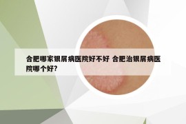 合肥哪家銀屑病醫(yī)院好不好 合肥治銀屑病醫(yī)院哪個(gè)好?