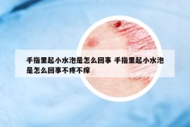 手指里起小水泡是怎么回事 手指里起小水泡是怎么回事不疼不癢