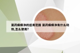 苗藥癬癢凈的適用范圍 苗藥癬癢凈有什么功效,怎么使用?