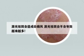激光祛斑會造成白癜風(fēng) 激光祛斑會不會導(dǎo)致越來越多!