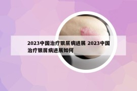 2023中國治療銀屑病進展 2023中國治療銀屑病進展如何