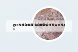 gxb多維白癜風 有白斑能吃多維元素片21