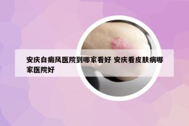 安慶白癜風(fēng)醫(yī)院到哪家看好 安慶看皮膚病哪家醫(yī)院好