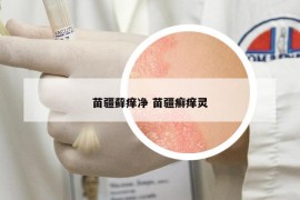 苗疆蘚癢凈 苗疆癬癢靈